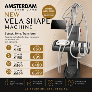 V-Shape